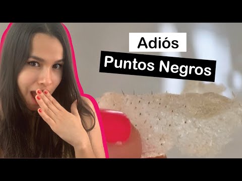 Elimina Puntos Negros Y Espinillas Con Sólo 2 Ingredientes!